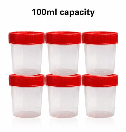 Sterile Biopsy Container - 100ml